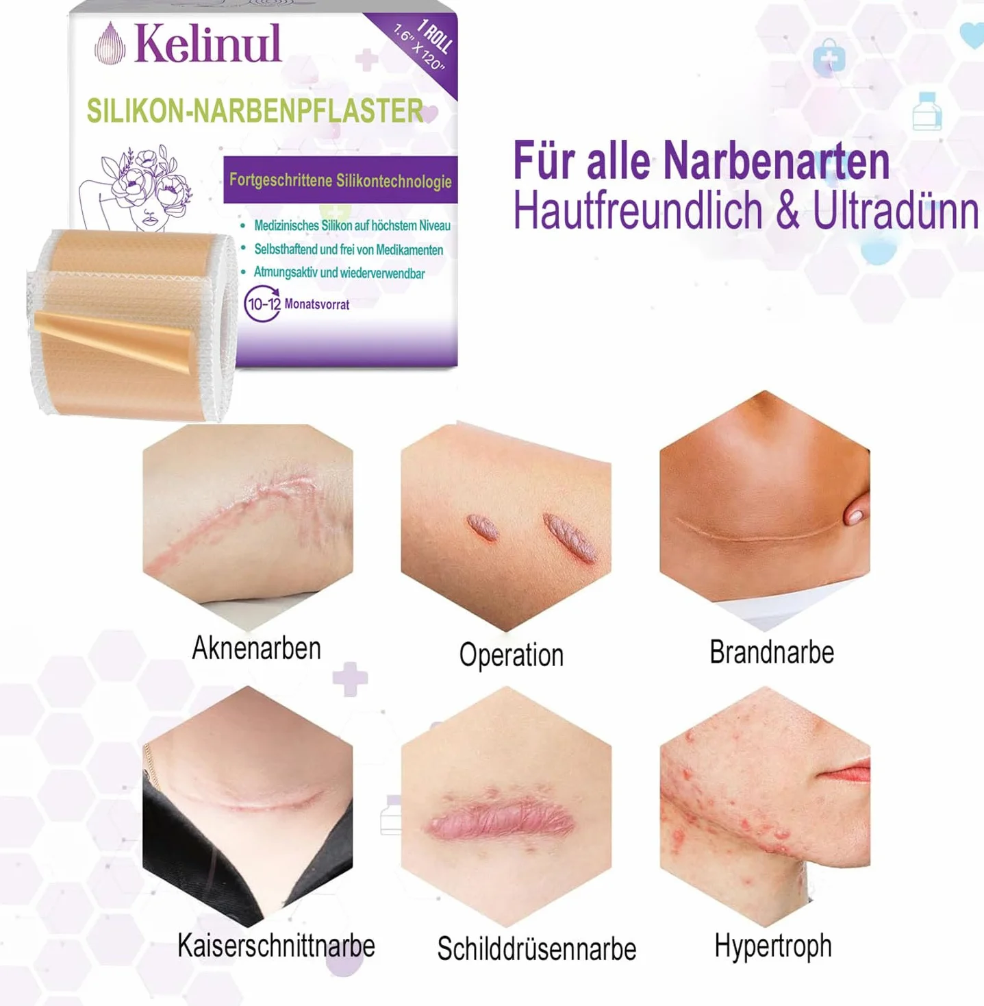 Hojas de cicatriz de silicona - cinta de cicatriz de Gel de silisuave - tiras de cicatriz reutiliz, de grado médico